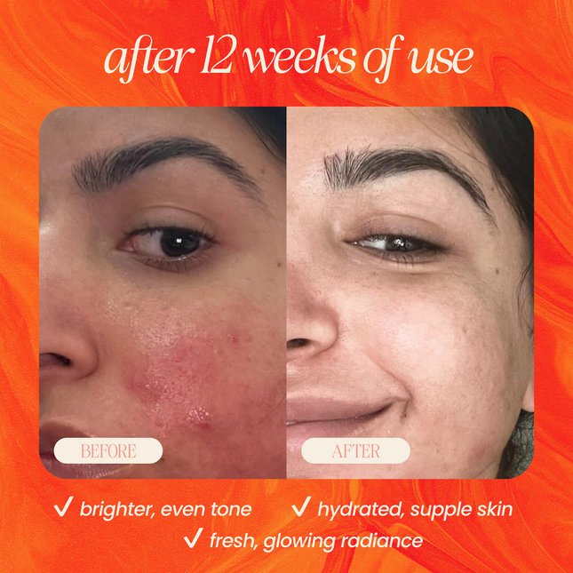 Pineapple & Rosehip Vitamin C Serum