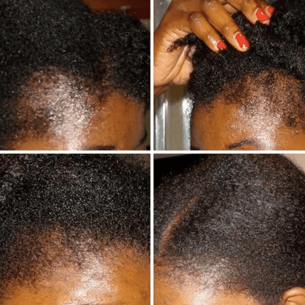 Hair Oil Mega Ayurvedic Growth
